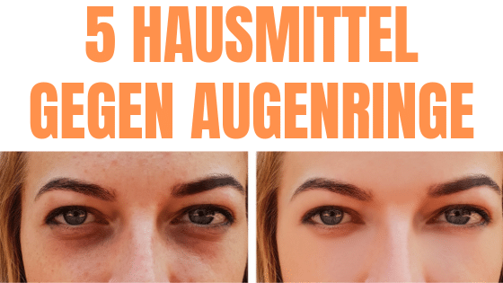 Augenringe Entfernen Die 5 Besten Hausmittel Lebensheld